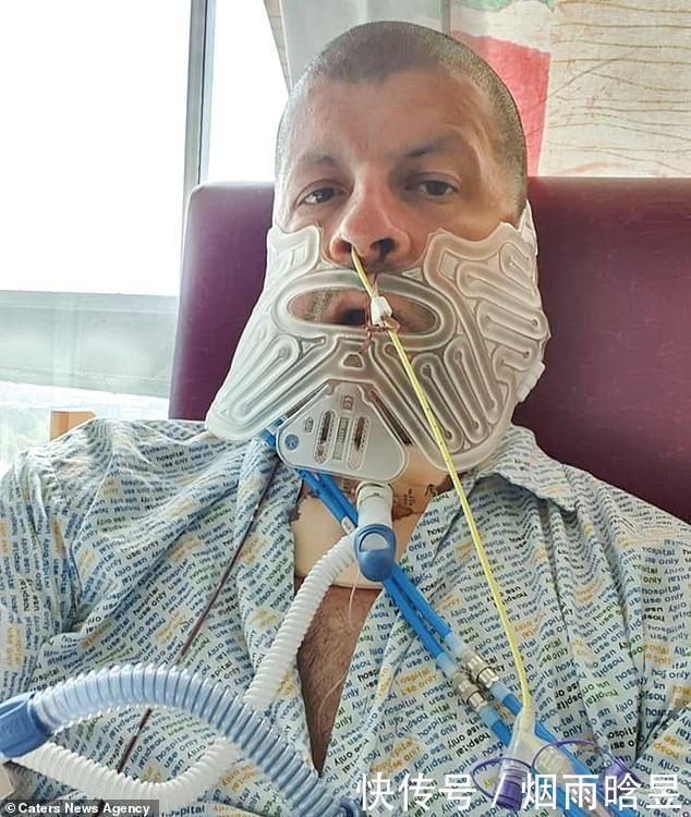  恐惧|英男子恐惧看牙医，27年后终做检查：下巴长拳头大肿瘤被迫摘除