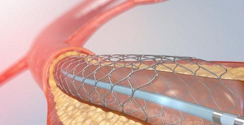  治疗|不需要“过度医疗”，哪些手术可不做偏要做？哪些药可不吃偏要吃