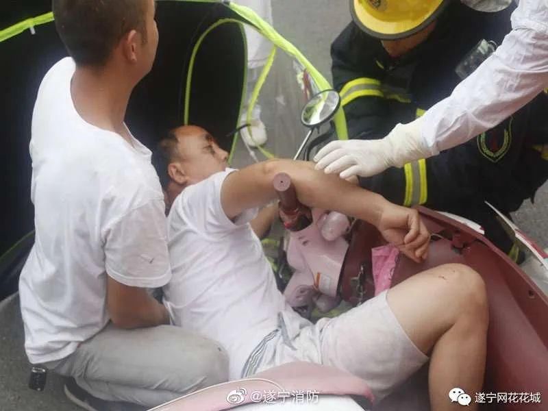  刺穿|看到都痛！男子骑电动车撞到半挂车，右手被刹车把手刺穿