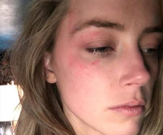  厕所|德普与前妻再战法庭！自曝曾被打到躲厕所过夜，女方还在床上大便