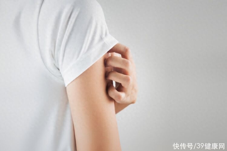 皮肤出现这3种可能是艾滋病信号(不要错把艾滋病当皮肤病，身体若有3处变化，或是艾滋病的信号！)