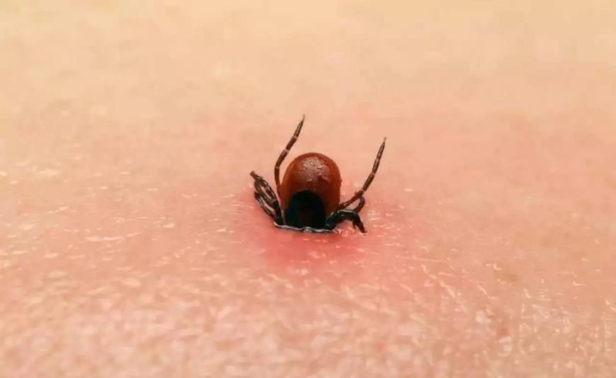  虫子|重要: 被咬一口致命, 这虫子随处可见, 干农活千万要注意