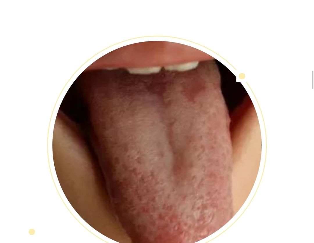  变化|身体健康情况怎么样？可以从舌头进行窥探