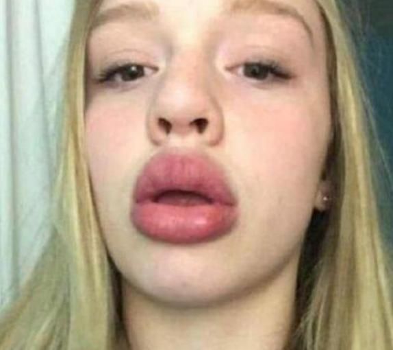 恶习|女孩子想变“樱桃唇”,3个恶习趁早改,否则“火锅嘴”没人爱