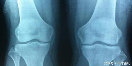 孩子身高|孩子如何长高高?父母想知道的营养秘籍在这里!别傻傻只会补钙了