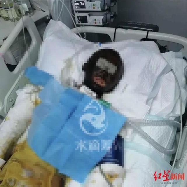 女子|愤怒！网红女子直播时遭前夫用汽油纵火，重度烧伤