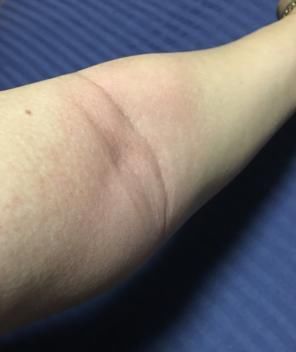 部位|怎样坚持拍打同一个部位一小时?