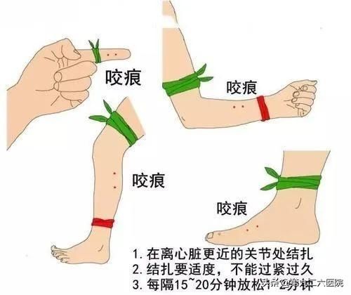  健康|【健康科普】近期蛇咬伤频发，下面这些知识建议收藏！
