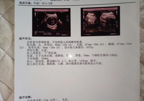  不想|“妈妈我被锁喉啦!”不想宝宝被脐带绕颈，最好别做这三件事