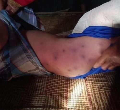  蜂巢|奶奶砍树叶时不小心撞到黄蜂巢，柬5岁男孩遭到攻击，不幸被咬死