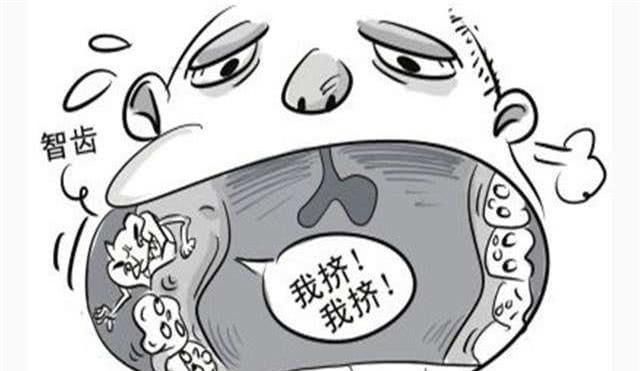  智齿|为什么拔出来的智齿会这么臭？听完医生的解释，觉得“难为情”