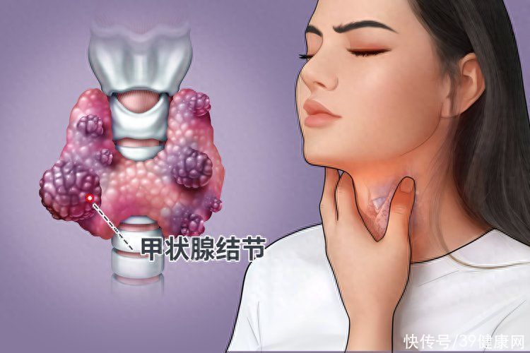 吃牛肉对结节有什么危害(牛肉是“结节催化剂”？提醒：不想结节恶化，尽量少吃4种食物)