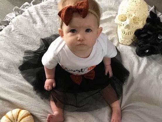  不料|夫妇参加聚会将17月大女儿留在卧室，不料孩子被宠物狗咬死