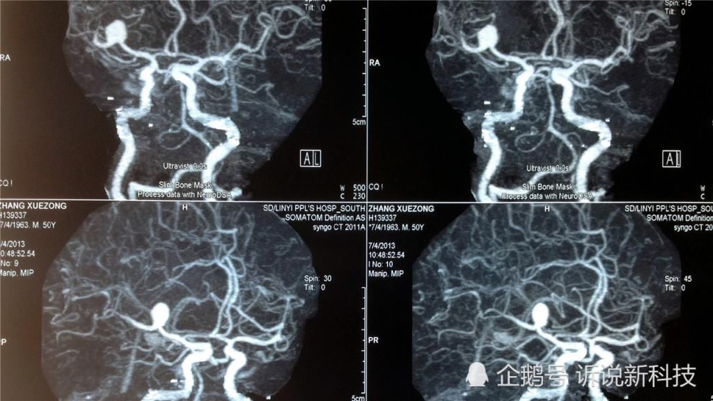  开发|人类大脑的开发，都受哪些因素的制约？为何如今只开发了1成？