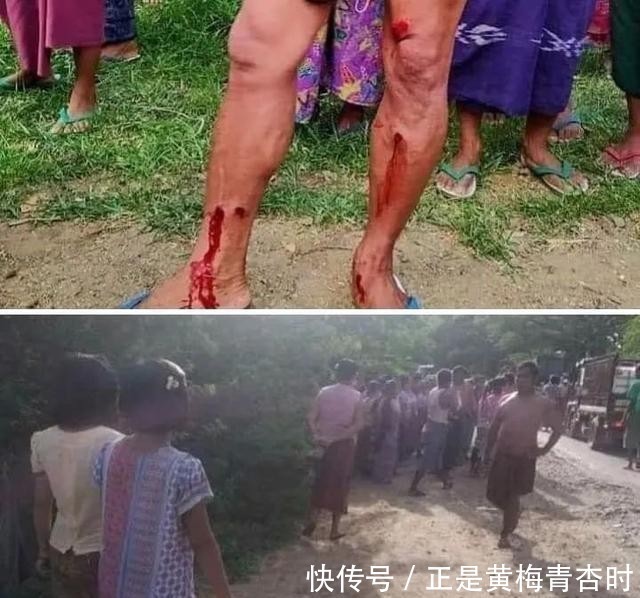 子弹|缅甸小镇爆发警民冲突，警方发射橡胶子弹，有村民被打伤