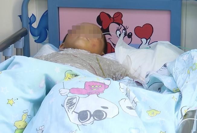  上山|命悬一线！贵州4岁男童上山采蘑菇，不幸被蛇咬伤