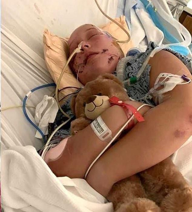  乔斯林|两条斗牛犬突然追赶15岁少女将其扑倒，疯狂啃咬其脖子和脑袋