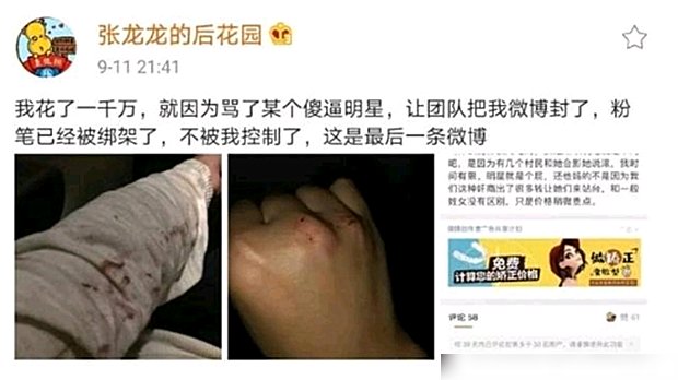  沈梦辰|沈梦辰参加节目被赞助商大骂，获王思聪点赞，此料非假？