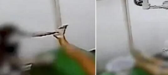 气炸|女子意外看到自己在医院身体整形视频现场细节让她气炸