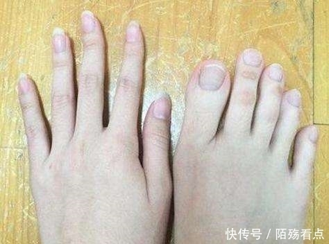 技师|女子做足疗,脱鞋后大家蒙了,技师:按脚十年从来没遇到过