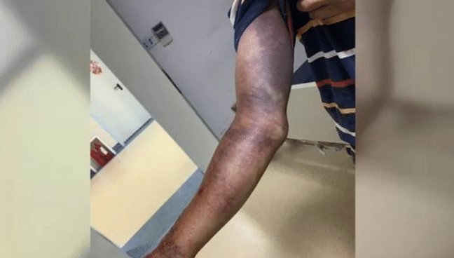  车上|一根“枯树枝”挂在车上, 司机伸手拿掉, 结果进医院抢救