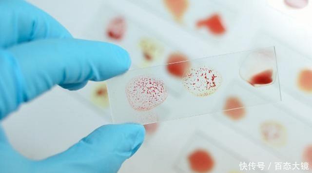  血型|这个血型的女人，“避孕药”都阻止不了她受孕，医生：体质问题