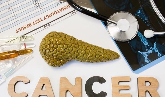  死亡|27年治癌经验，肿瘤专家患上胰腺癌晚期，从确诊到死亡仅15个月