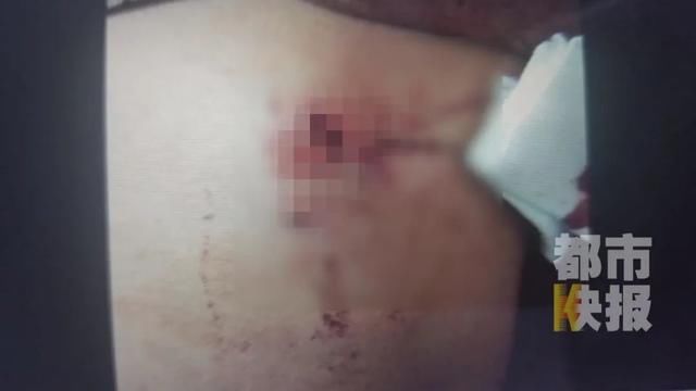 调查|有人抢微信号!陕西一高中生被几人扎伤!警方调查:受害者达十多人