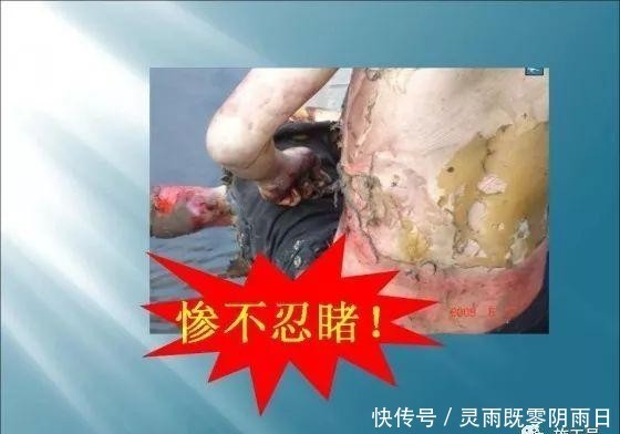 事故|建筑施工现场事故案例分析图文