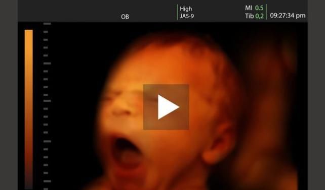  怀胎|怀胎十月，胎儿每天在肚子里都干些什么？看完感觉好有爱！