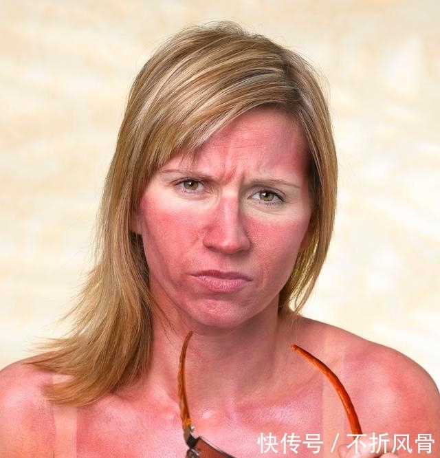 皮肤|涂了防晒就完事？晒后修复更重要，三招教你如何“拯救”晒后肌肤