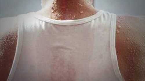  天天|永康姑娘30多年来天天“汗流成河”原来“多汗”是一种病