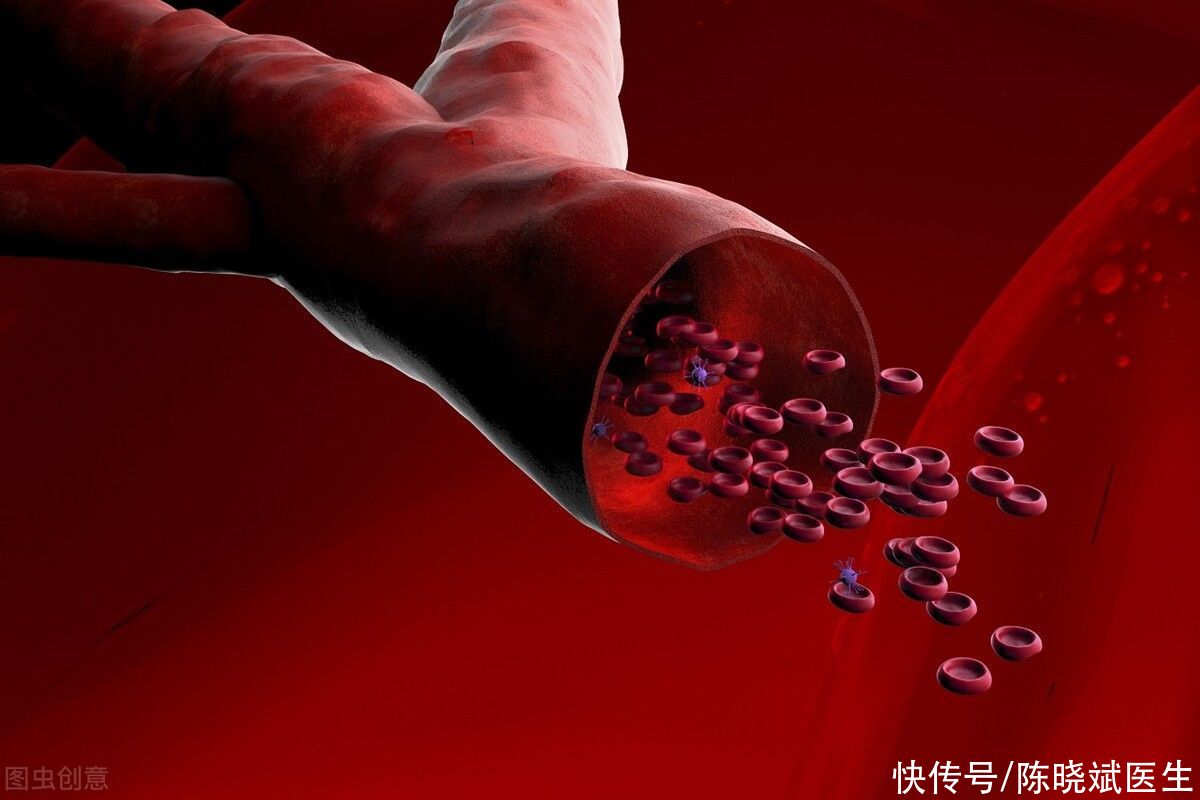 真正软化血管的方法只有一个(别再被“软化血管”忽悠了！坚持做好这4点，延缓血管老化)