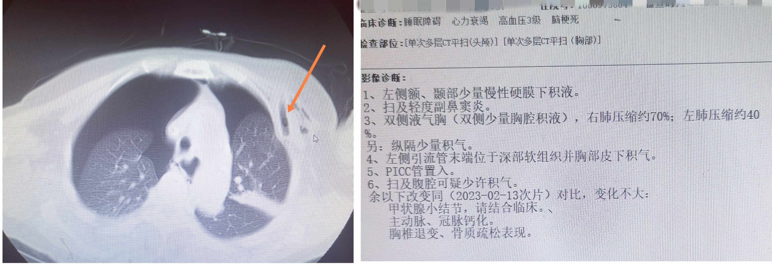 想说爱你不容易(麻醉，想说爱你不容易)