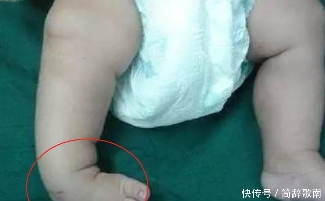  胳膊|父母热衷于牵着宝宝学走路，反而“费力不讨好”，娃受伤都不知道