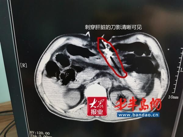  男子|胶州男子家中轻生自杀后悔，打电话向妻子求救