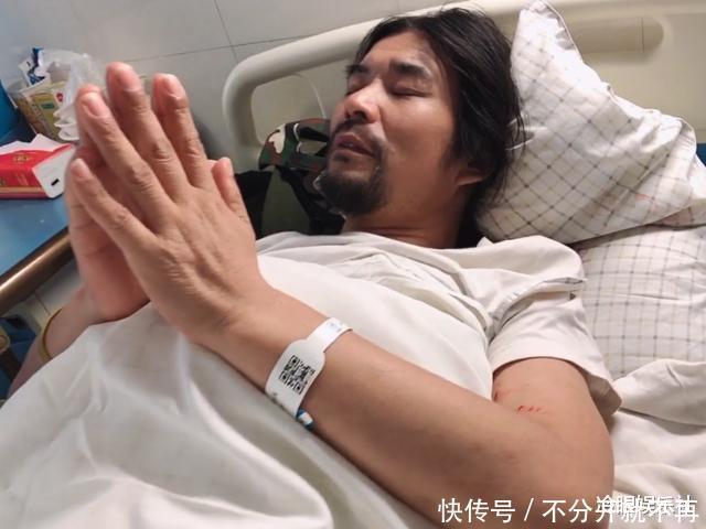 肺癌|“面筋哥”程书林肺癌晚期却瞒着家人,带病录歌让人看着心酸