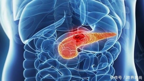 糖尿病|干货;糖尿病能治好吗?患病10年的糖友道出你想要的4个真相