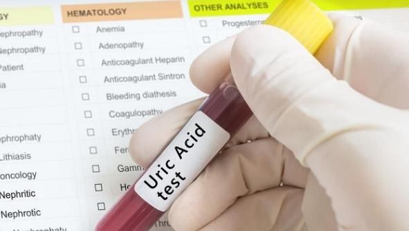  女性|45岁以上要警惕高尿酸痛风来袭，这5类饮食，尽量不要端上桌