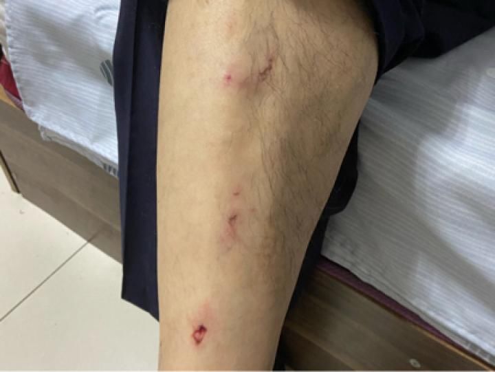  跳河|男子欲跳河轻生 民警迅速施救