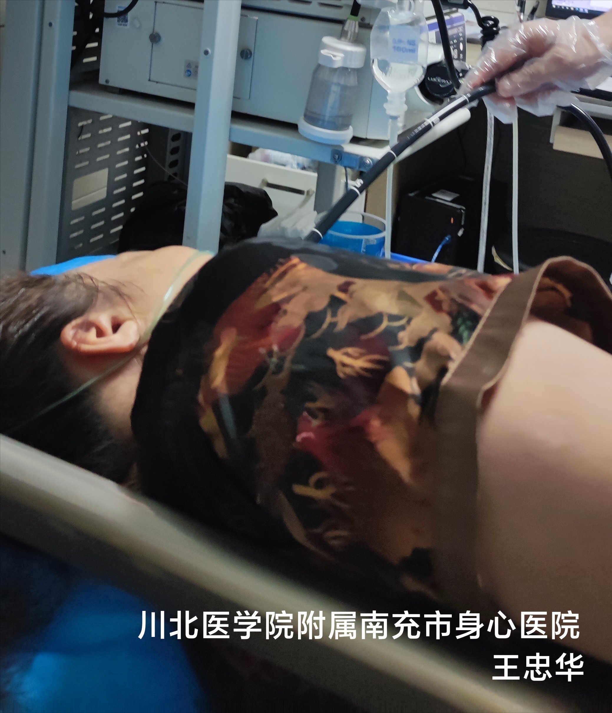 无痛胃肠镜检查完整过程(无痛胃肠镜：让检查更舒适)
