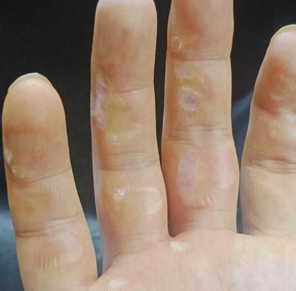  拉住|拉住他，不放手！