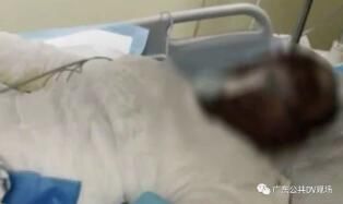 父亲|客厅突然爆炸起火!父亲为救孩子被严重烧伤进ICU!祸首又是这个…