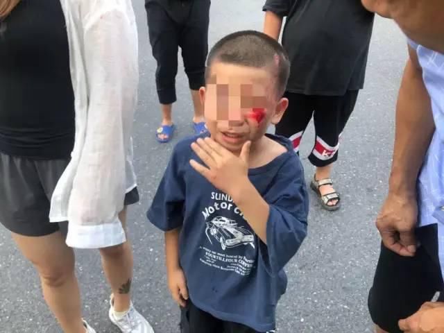  事故|司机刚启动车子，突然从车底传出一声尖叫