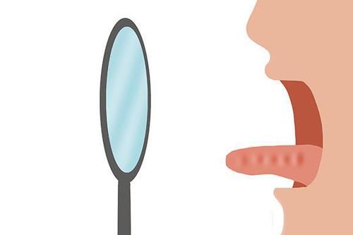  生病|舌头是身体晴雨表，哪些变化，说明你可能生病了？自测一下