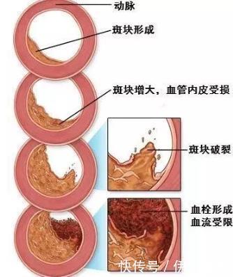 危险|你知道在中国哪种疾病比癌症对中国人的健康更危险吗