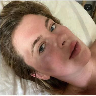 鲍德温|24岁超模在停车场遭袭击！面部被打淤青明显，钱财也被洗劫一空