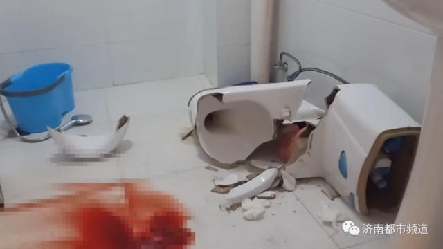  左小腿|济南一女子如厕，马桶突然爆裂！缝了二十多针……