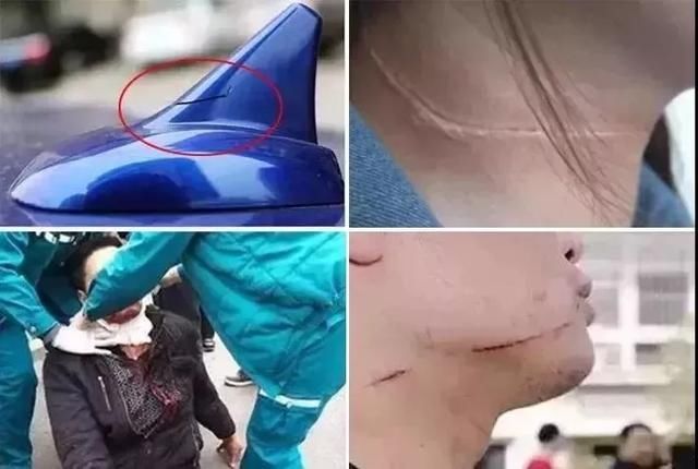  女孩|飞来横祸！浙江一名23岁女孩骑电动车惨遭“割喉”，罪魁祸首万万想不到