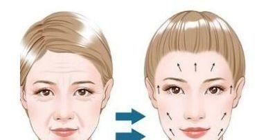  医生|皮肤科医生科普热玛吉——操作过程及患者问答，看完就不懵了